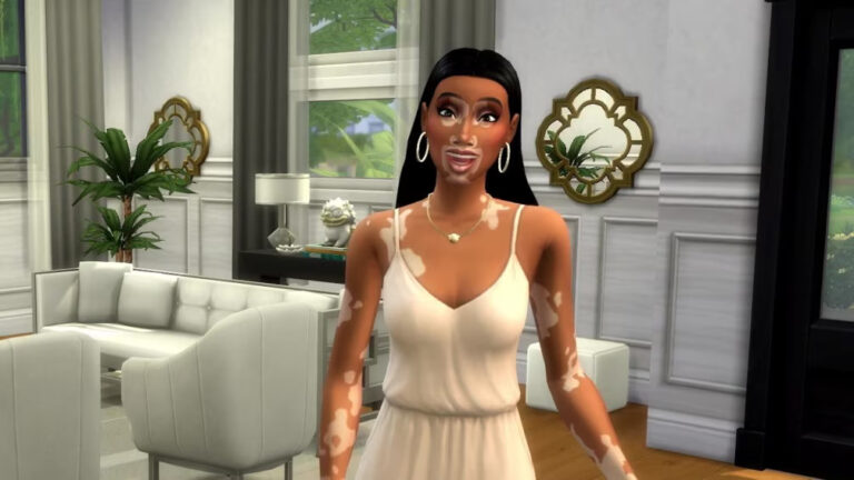 Celebrating Differences: ‘The Sims 4’ Introduces Vitiligo in Latest Update